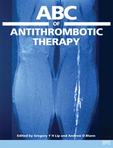 ABC of Antithrombotic Therapy by Gregory Y. H. Lip【ebook】