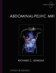 Abdominal-Pelvic MRI 3rd Edition, 2 Volume Set by Richard C. Semelka, M.D.【ebook】