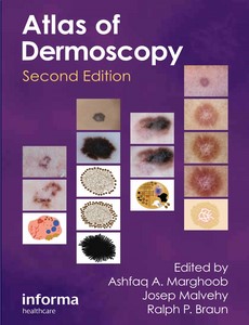 An Atlas of Dermoscopy, Second Edition by Ashfaq Marghoob【ebook】