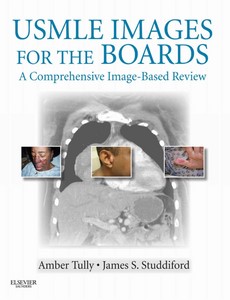 USMLE Images for the Boards A Comprehensive Image-Based Review by Amber S. Tully【ebook】